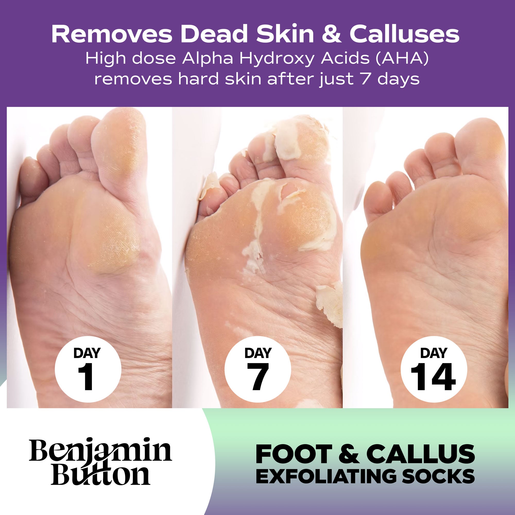 Exfoliating Foot Peel Mask – AHA Foot Peeling Mask – 5 Pack