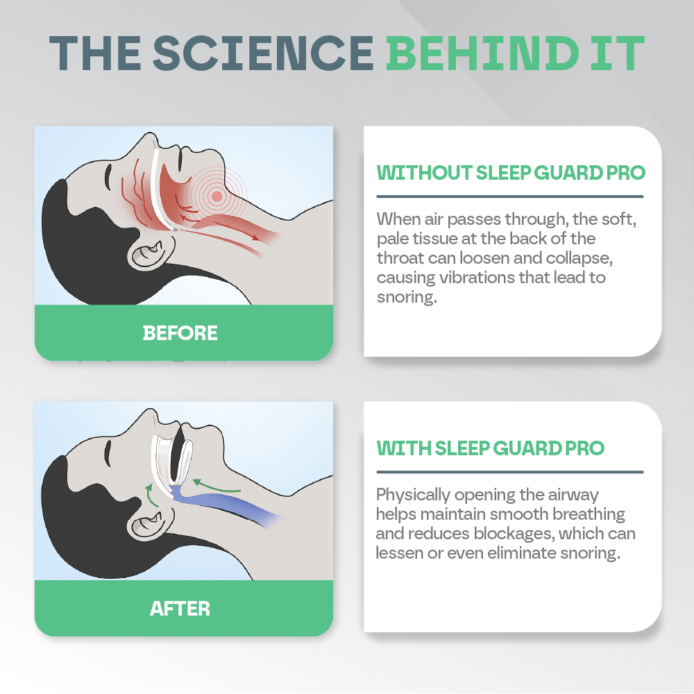 Anti Snore Mouth Guard Pro