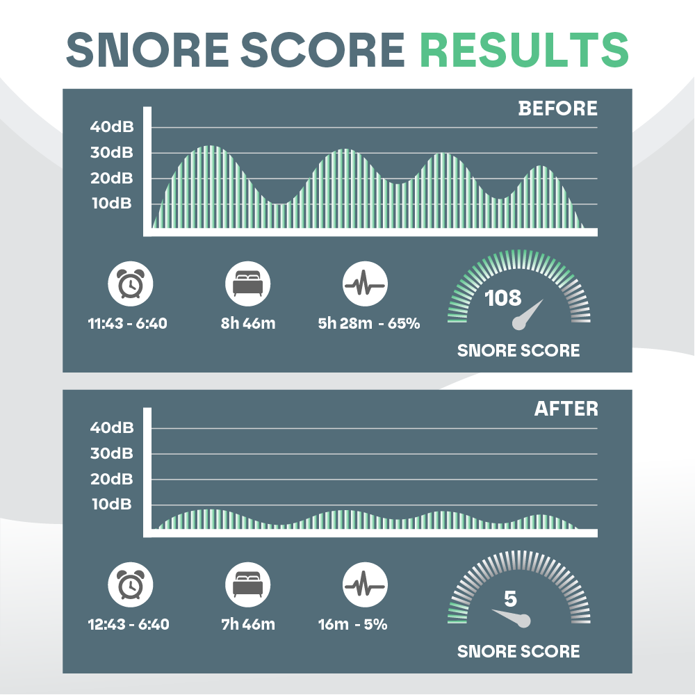 Anti Snore Mouth Guard Pro